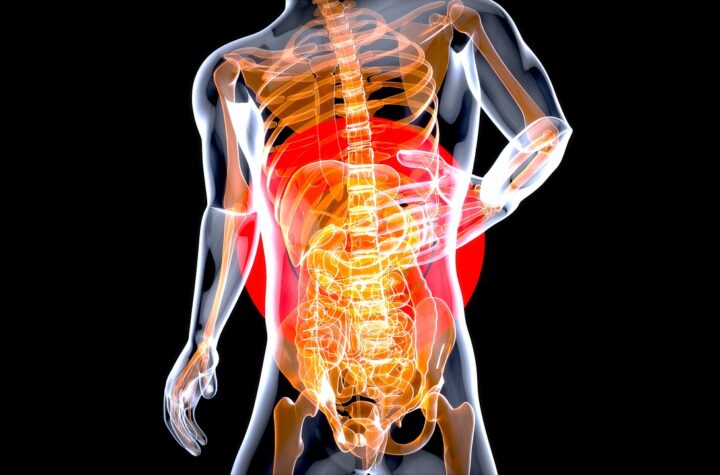 Gas and Bloating