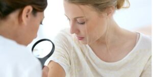 acne treatment Westminster CA